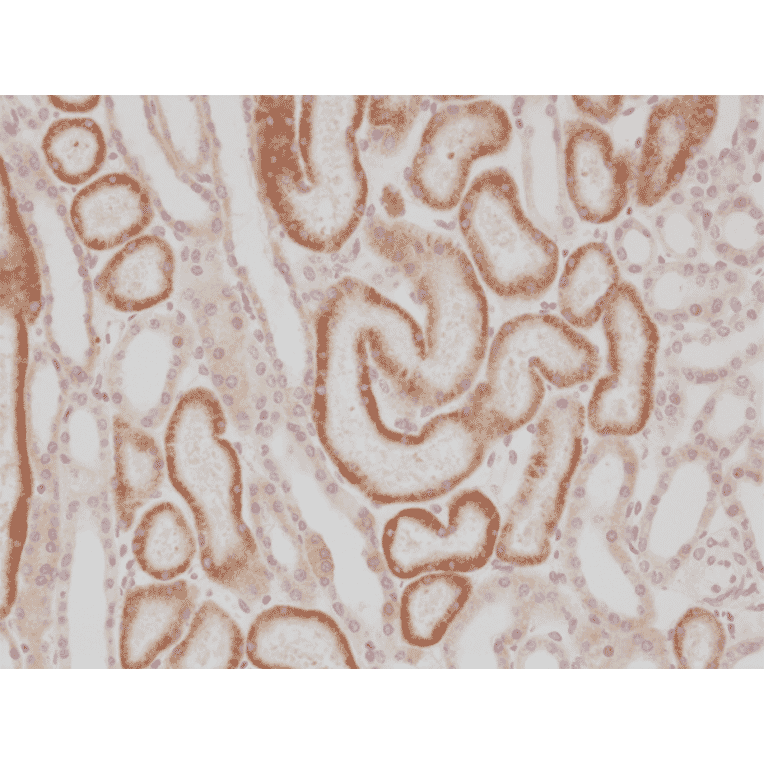 Immunohistochemistry - Anti-AMACR Antibody [RM349] (A121475) - Antibodies.com