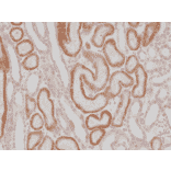 Immunohistochemistry - Anti-AMACR Antibody [RM349] (A121475) - Antibodies.com