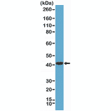 Western Blot - Anti-AMACR Antibody [RM349] (A121502) - Antibodies.com