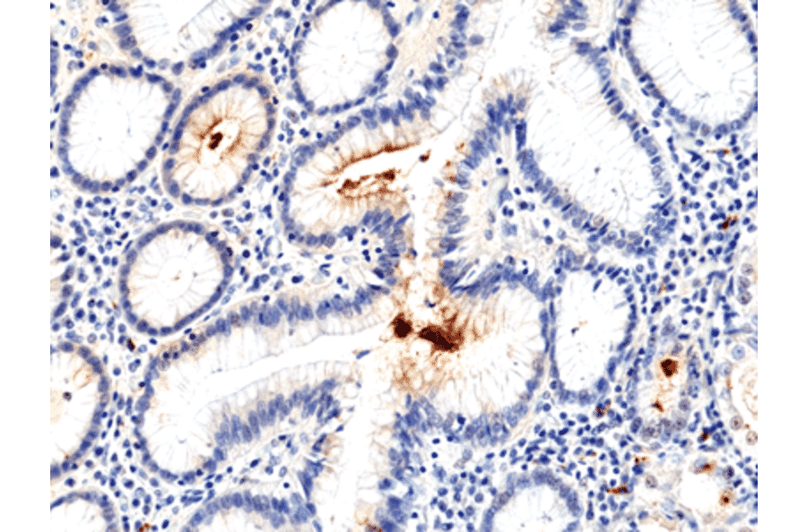 Immunohistochemistry - Anti-Helicobacter pylori Antibody [RM400] (A121484) - Antibodies.com