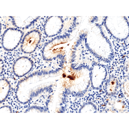 Immunohistochemistry - Anti-Helicobacter pylori Antibody [RM400] (A121484) - Antibodies.com