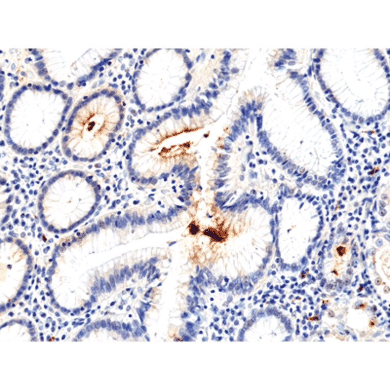 Immunohistochemistry - Anti-Helicobacter pylori Antibody [RM400] (A121484) - Antibodies.com