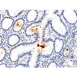 Immunohistochemistry - Anti-Helicobacter pylori Antibody [RM400] (A121484) - Antibodies.com