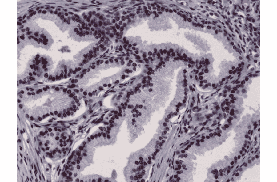Immunohistochemistry - Anti-Androgen Receptor Antibody [RM254] (A121505) - Antibodies.com