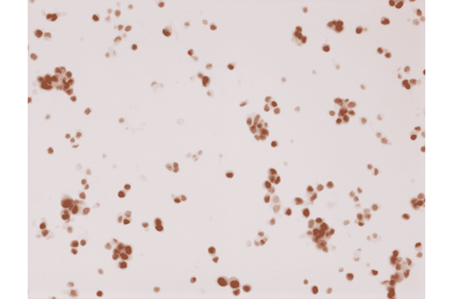 Immunohistochemistry - Anti-Androgen Receptor Antibody [RM254] (A121400) - Antibodies.com