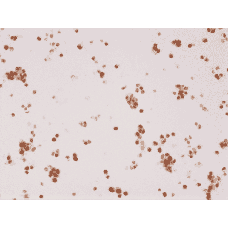 Immunohistochemistry - Anti-Androgen Receptor Antibody [RM254] (A121400) - Antibodies.com