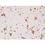 Immunohistochemistry - Anti-Androgen Receptor Antibody [RM254] (A121400) - Antibodies.com