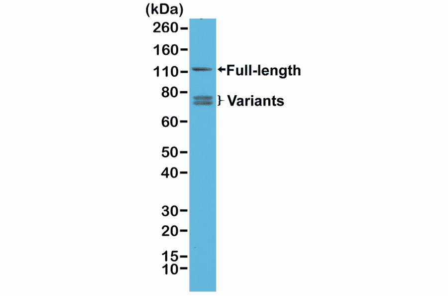 Western Blot - Anti-Androgen Receptor Antibody [RM254] (A121505) - Antibodies.com