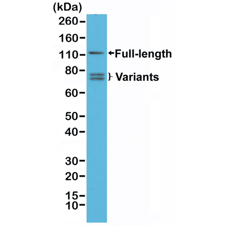 Western Blot - Anti-Androgen Receptor Antibody [RM254] (A121505) - Antibodies.com