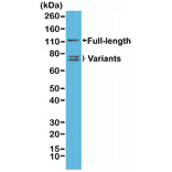 Western Blot - Anti-Androgen Receptor Antibody [RM254] (A121505) - Antibodies.com