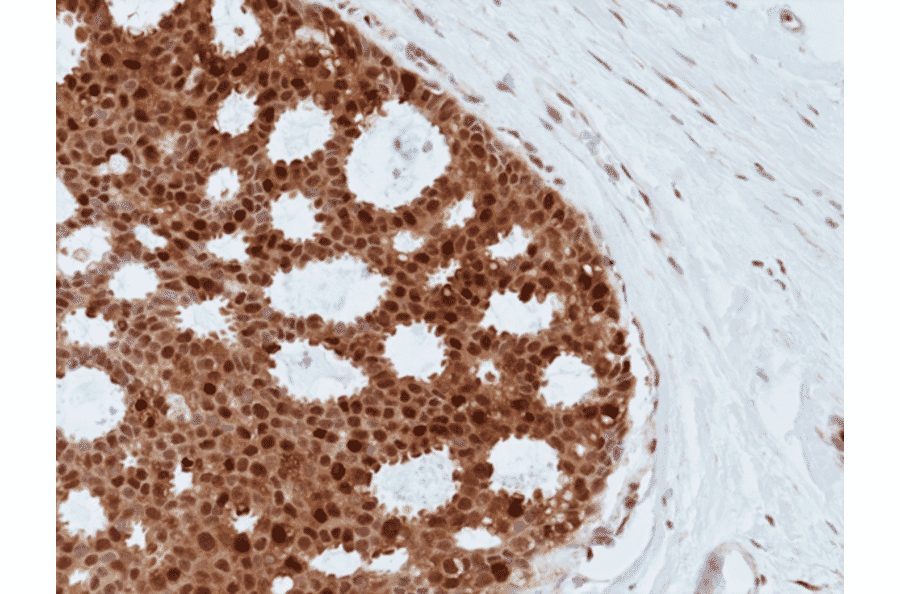 Immunohistochemistry - Anti-BAG1 Antibody [RM356] (A121468) - Antibodies.com