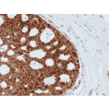Immunohistochemistry - Anti-BAG1 Antibody [RM356] (A121468) - Antibodies.com