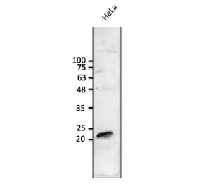 Western Blot - Anti-RAB1B Antibody (AB0017) - Antibodies.com
