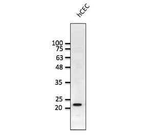 Western Blot - Anti-RAB1B Antibody (AB0018) - Antibodies.com