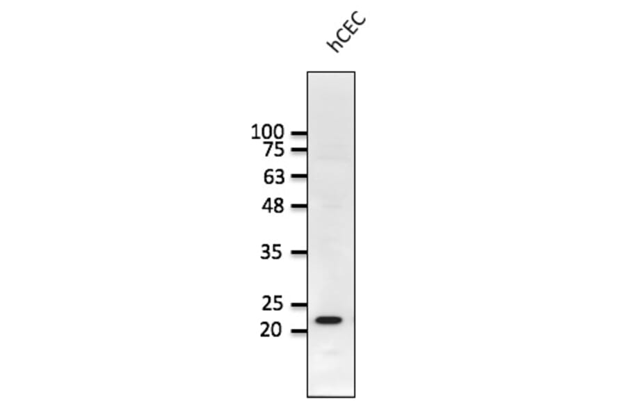 Western Blot - Anti-RAB1B Antibody (AB0018) - Antibodies.com
