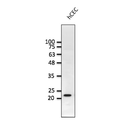 Western Blot - Anti-RAB1B Antibody (AB0018) - Antibodies.com