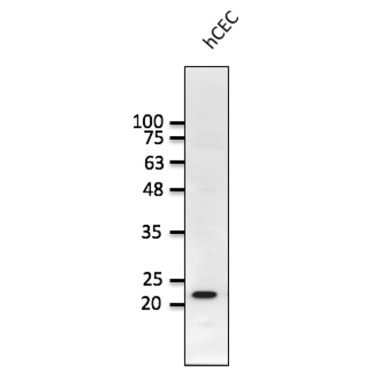 Western Blot - Anti-RAB1B Antibody (AB0018) - Antibodies.com