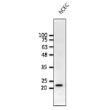 Western Blot - Anti-RAB1B Antibody (AB0018) - Antibodies.com
