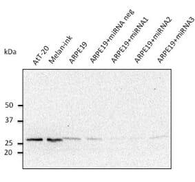 Western Blot - Anti-RAB27A Antibody (AB0023) - Antibodies.com