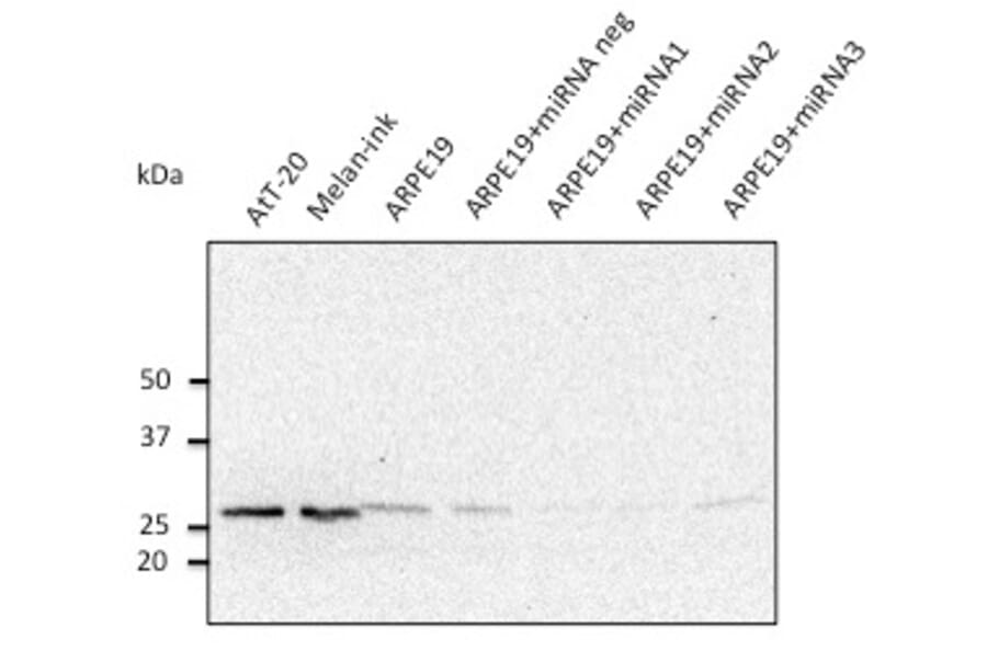 Western Blot - Anti-RAB27A Antibody (AB0023) - Antibodies.com
