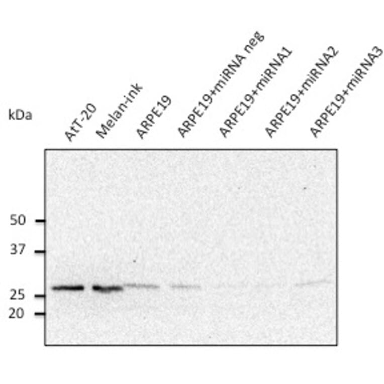 Western Blot - Anti-RAB27A Antibody (AB0023) - Antibodies.com