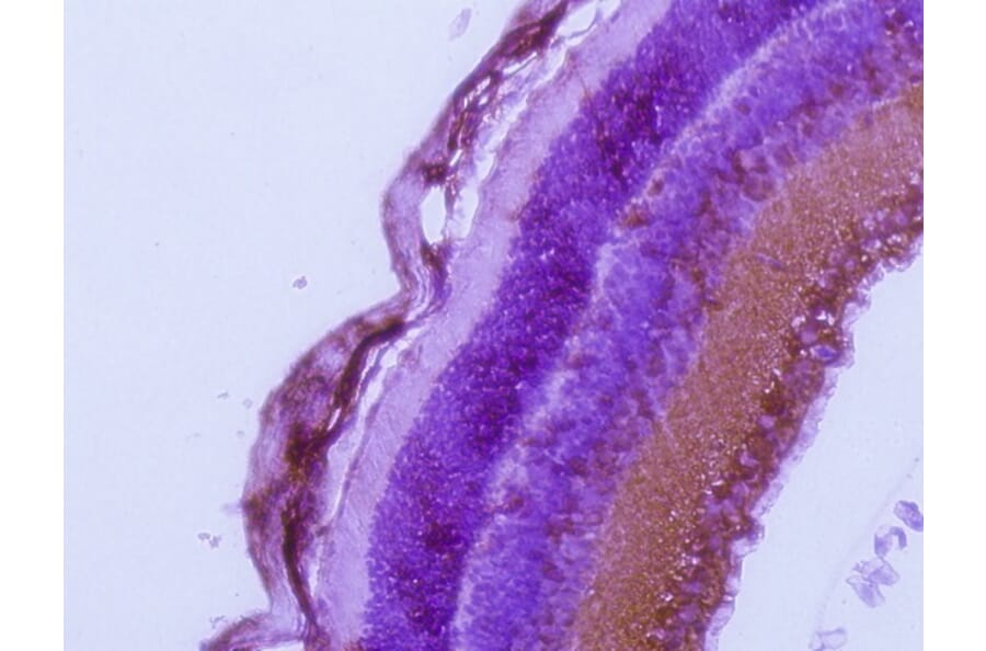 Immunohistochemistry - Anti-RAB27A Antibody (AB0023) - Antibodies.com