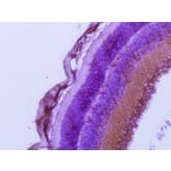Immunohistochemistry - Anti-RAB27A Antibody (AB0023) - Antibodies.com