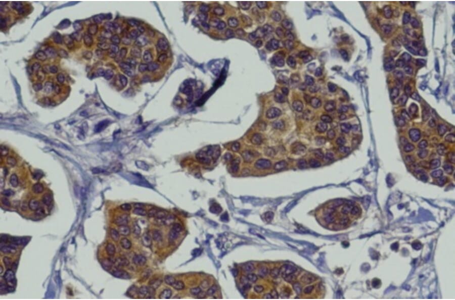 Immunohistochemistry - Anti-RAB27A Antibody (AB0023) - Antibodies.com