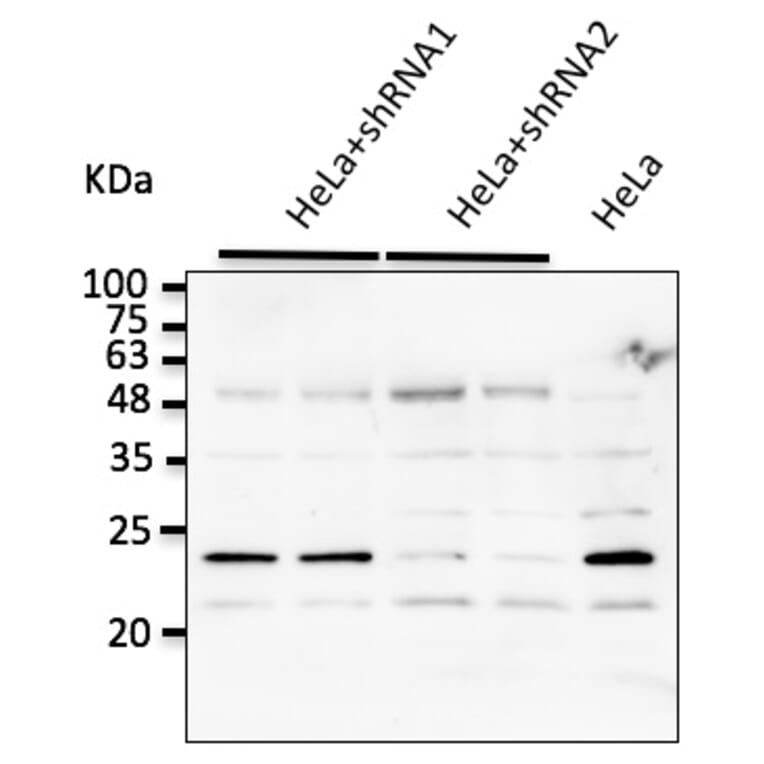 Western Blot - Anti-RAB7A Antibody (AB0033) - Antibodies.com