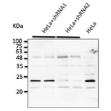 Western Blot - Anti-RAB7A Antibody (AB0033) - Antibodies.com
