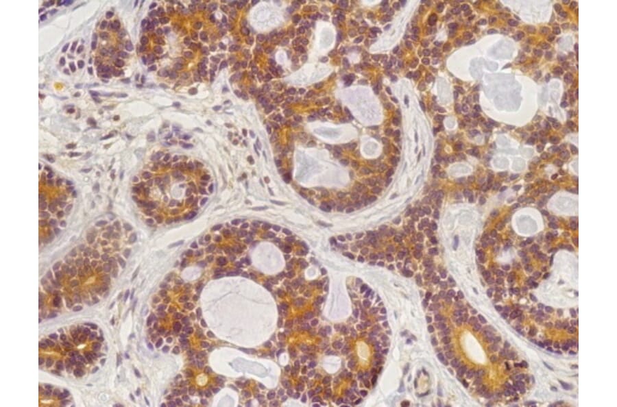 Immunohistochemistry - Anti-RAB25 Antibody (AB0035) - Antibodies.com