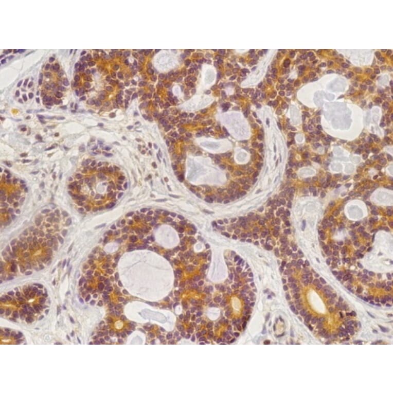 Immunohistochemistry - Anti-RAB25 Antibody (AB0035) - Antibodies.com