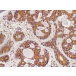 Immunohistochemistry - Anti-RAB25 Antibody (AB0035) - Antibodies.com
