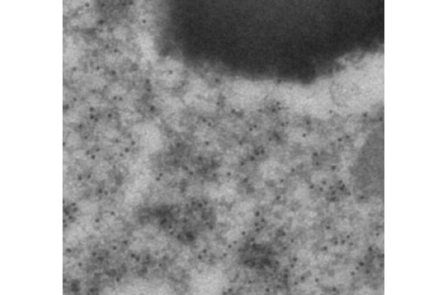 Immune Electron Microscopy - Anti-mCherry Antibody (AB0040) - Antibodies.com