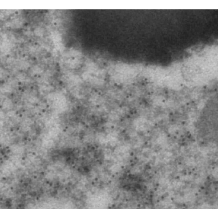 Immune Electron Microscopy - Anti-mCherry Antibody (AB0040) - Antibodies.com