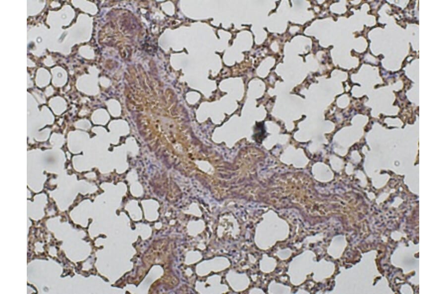 Immunohistochemistry - Anti-Cathepsin D Antibody (AB0043) - Antibodies.com