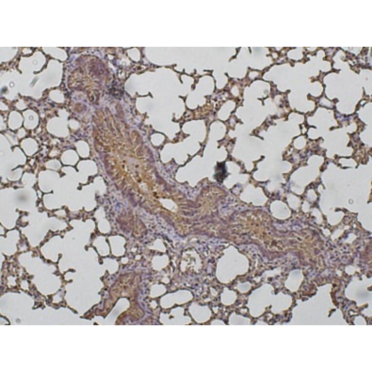 Immunohistochemistry - Anti-Cathepsin D Antibody (AB0043) - Antibodies.com