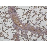 Immunohistochemistry - Anti-Cathepsin D Antibody (AB0043) - Antibodies.com