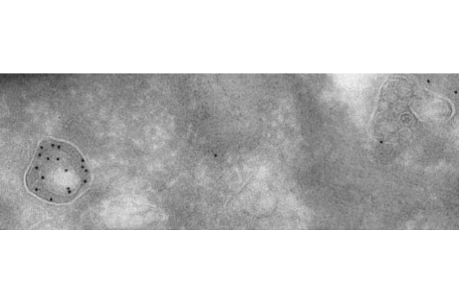 Immune Electron Microscopy - Anti-Cathepsin D Antibody (AB0043) - Antibodies.com