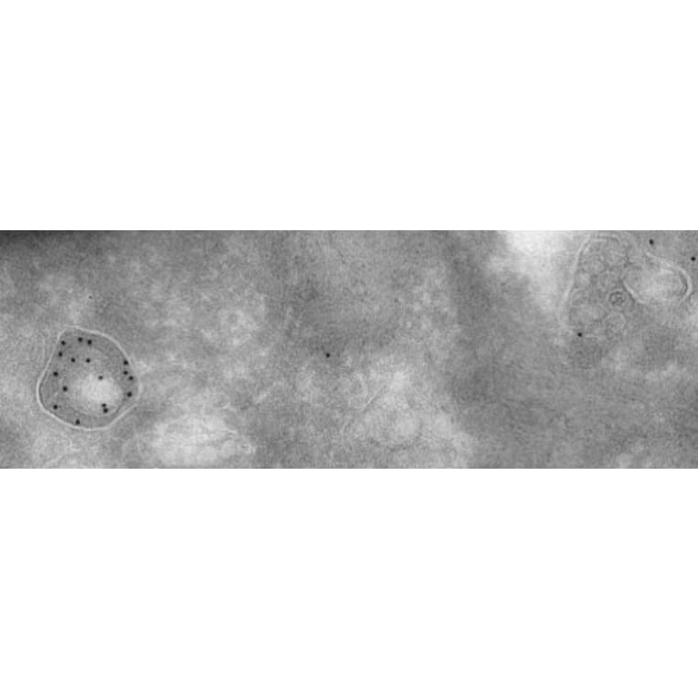 Immune Electron Microscopy - Anti-Cathepsin D Antibody (AB0043) - Antibodies.com