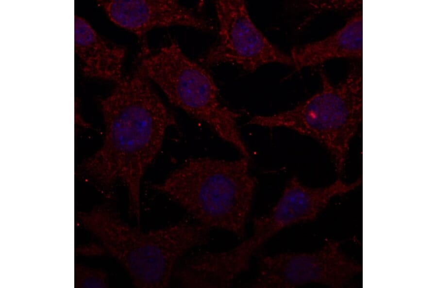 Immunoflouroscence - Anti-Cathepsin D Antibody (AB0043) - Antibodies.com