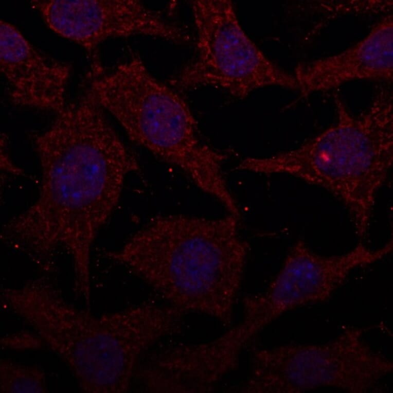 Immunoflouroscence - Anti-Cathepsin D Antibody (AB0043) - Antibodies.com
