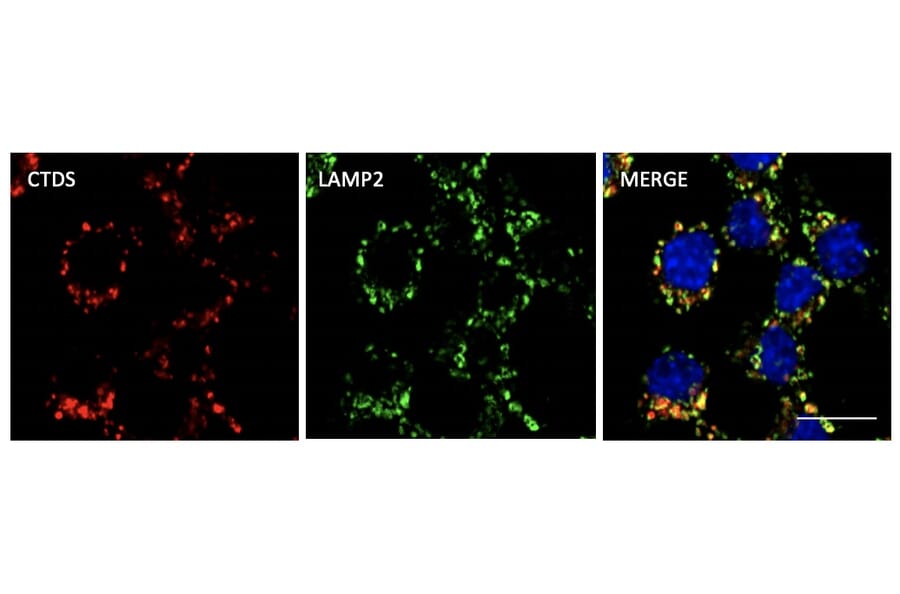 IF of fixed RAW264.7 stained with Anti-Cathepsin D (A121574)