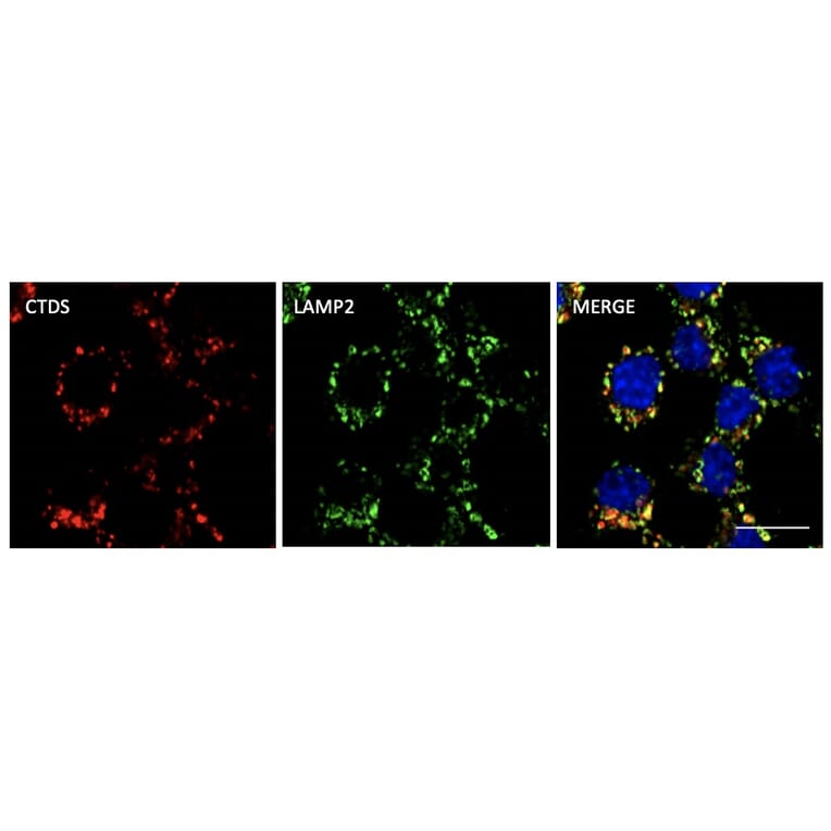 Immunoflouroscence - Anti-Cathepsin D Antibody (AB0043) - Antibodies.com
