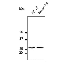 Western Blot - Anti-RAB27A Antibody (AB0045) - Antibodies.com