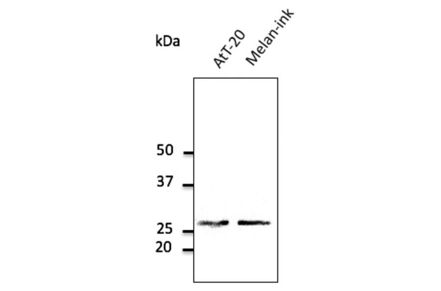 Western Blot - Anti-RAB27A Antibody (AB0045) - Antibodies.com
