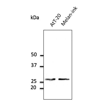 Western Blot - Anti-RAB27A Antibody (AB0045) - Antibodies.com
