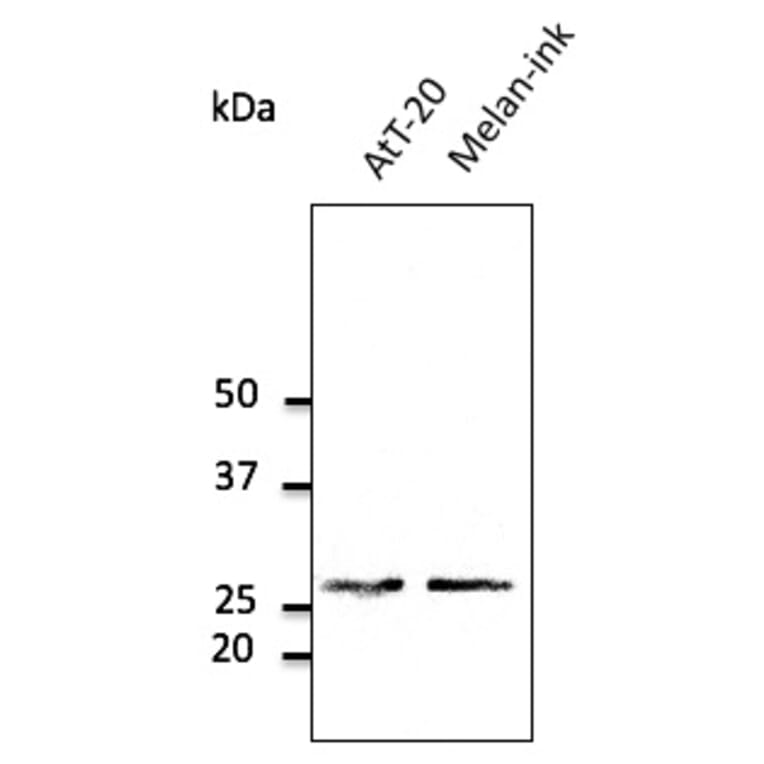 Western Blot - Anti-RAB27A Antibody (AB0045) - Antibodies.com