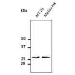 Western Blot - Anti-RAB27A Antibody (AB0045) - Antibodies.com