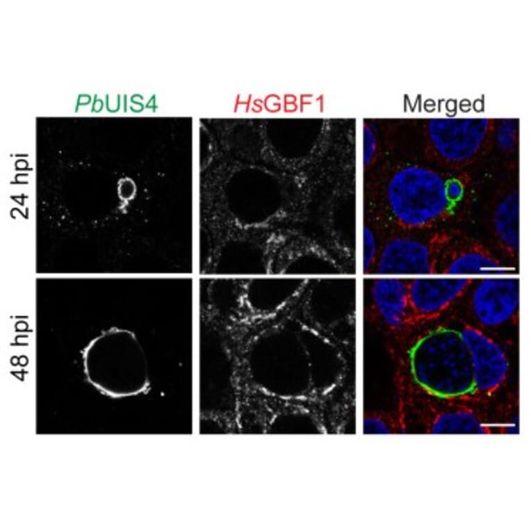 Immunofluorescence - Anti-UIS4 Antibody - Antibodies.com